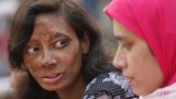 BD-women-violence-acid620.JPG