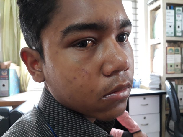কুড়িগ্রামে বিএসএফ এর গুলিতে আহত কিশোর রাসেল মিয়া।
