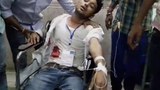 পঞ্চায়েত নির্বাচনে উত্তর ২৪ পরগনার বিলকান্দায় ছুরিকাঘাতে আহত এক রাজনৈতিক দলের এজেন্ট। ১৪ মে ২০১৮।