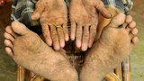 170316-IN-arsenic-620.jpg