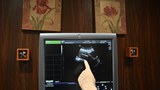 Indonesia widens abortion window for health emergencies, pregnancy due to rape