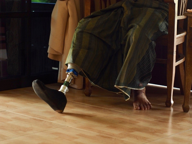 Taufik Abdul Halim wears a prosthetic leg during the BenarNews interview in Johor, Malaysia, Jan. 27, 2019. [Hadi Azmi/BenarNews]