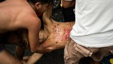 170802-PH-drugs-620.jpg