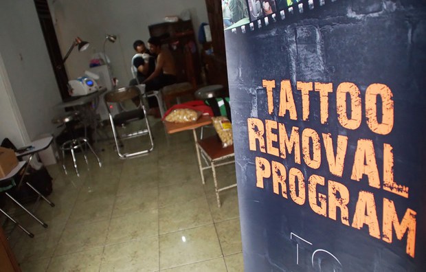 TATTO-REMOVAL-01.jpeg
