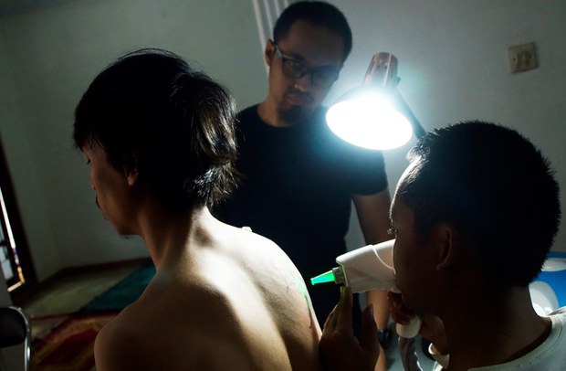 TATTO-REMOVAL-06.jpg