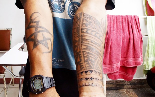 TATTO-REMOVAL-10.jpeg