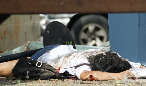 161102-TH-bomb-victim-1000.jpg 161102-TH-bomb-victim-1000.jpg