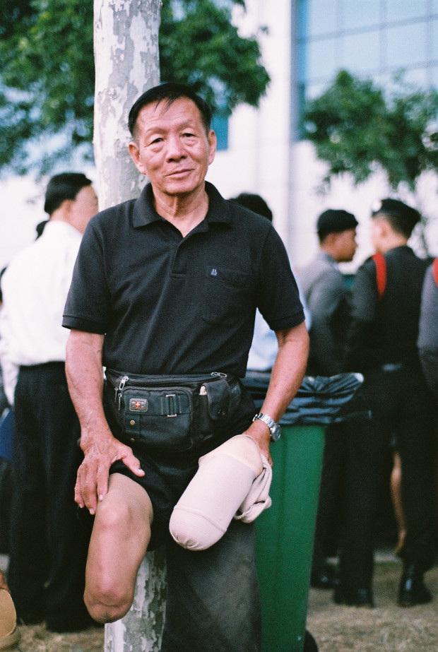 นายตี๋ แซ่เตียว สูญเสียขาขวาจากการสลายชุมนุมพันธมิตรฯ เมื่อวันที่ 7 ตุลาคม 2551 (นนทรัฐ ไผ่เจริญ/เบนาร์นิวส์)