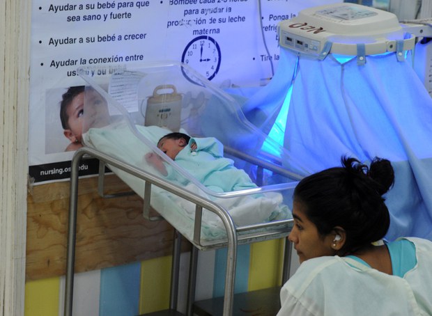 TH-baby-microcephaly-800 TH-baby-microcephaly-800