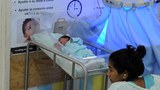 TH-baby-microcephaly-800