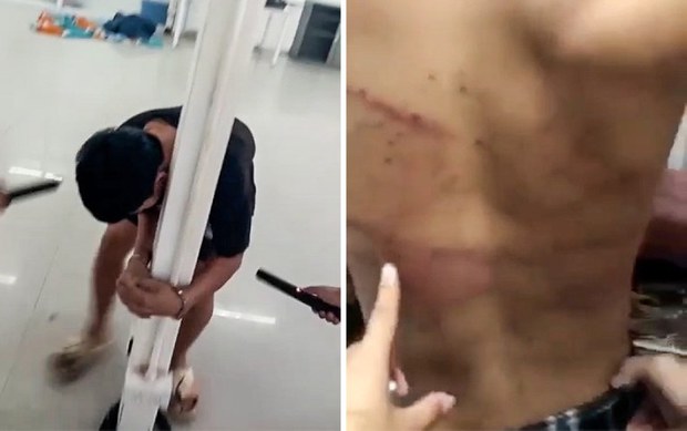 lao-mn-trafficking-casino 7 tortured.png
