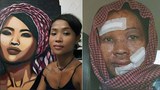 ศิลปินกัมพูชาเรียกร้องจับกุม 2 คนร้ายต่างชาติ หลังถูกมีดแทง-น้ำกรดราด