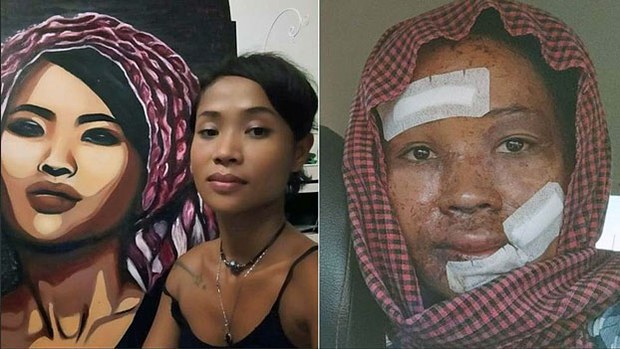 ศิลปินกัมพูชาเรียกร้องจับกุม 2 คนร้ายต่างชาติ หลังถูกมีดแทง-น้ำกรดราด ศิลปินกัมพูชาเรียกร้องจับกุม 2 คนร้ายต่างชาติ หลังถูกมีดแทง-น้ำกรดราด