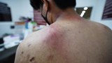 ศาลสั่งคุก 2 เดือน อาชีวะปกป้องสถาบันทำร้ายช่างภาพข่าว